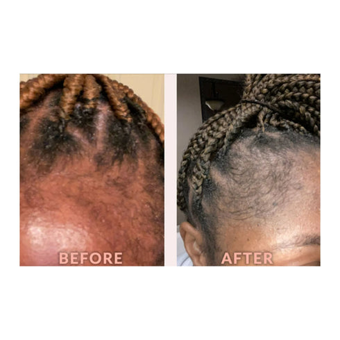 DESIGN EDGE & TEMPLE STRENGTHENING OIL 4 OZ (BIOTIN & BLACK CASTOR OIL)(DES00547)